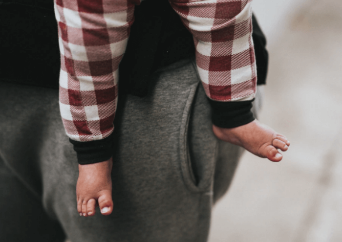 Congenital abnormalities flat feet